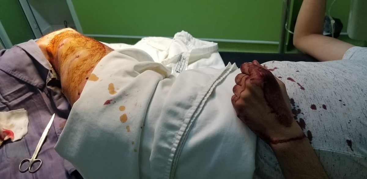 صفاقس: بعد  هدنة قصيرة عودة  البراكاجات