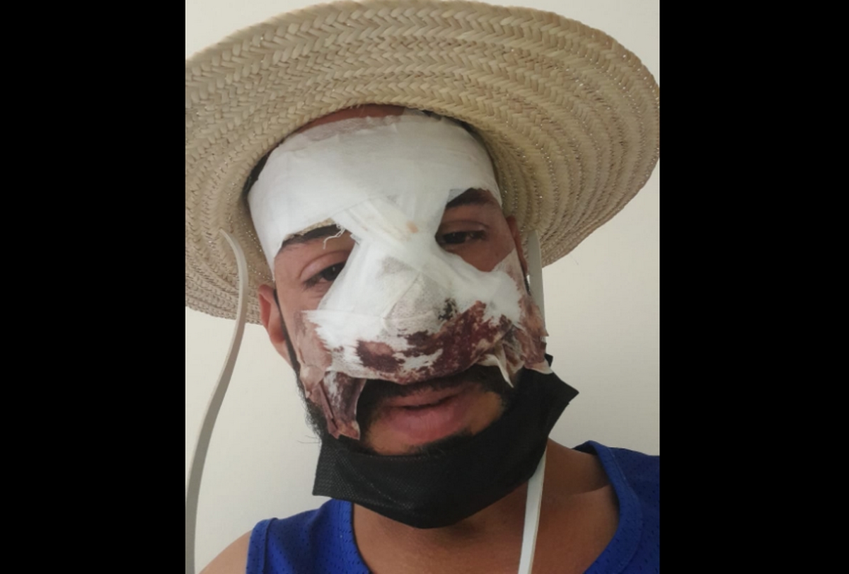 شكاية لدى وكيل الجمهورية  بعد الاعتداء بالعنف الشديد على عون بشركة الخطوط الجوية التونسية