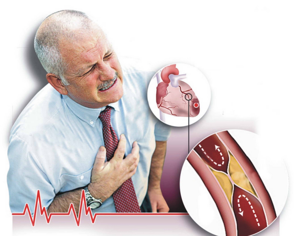 الدكتور محجوب العوني يوضّح فرضية تسبب تلقيح كورونا في الموت المفاجئ والجلطات القلبية