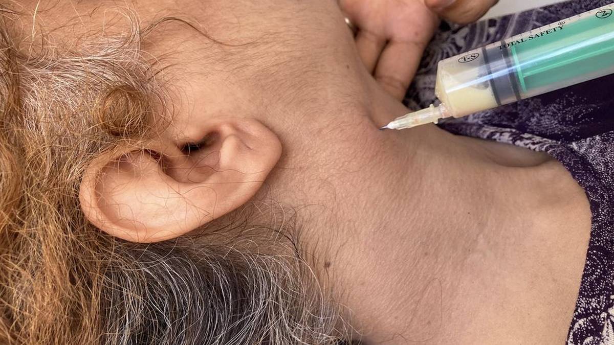 هل  يكون الحليب الطازج سبب مرض  السل في  الغدد  اللمفويّة