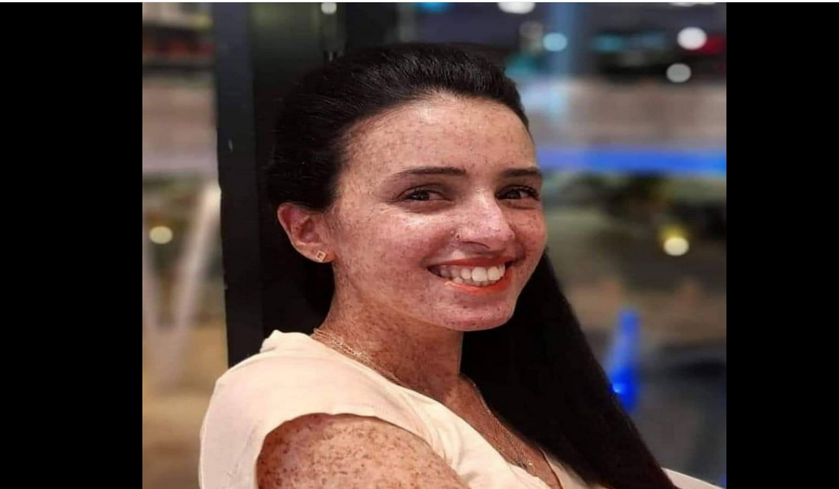 لمياء الحكيم شابّة من أطفال القمر في ذمة الله
