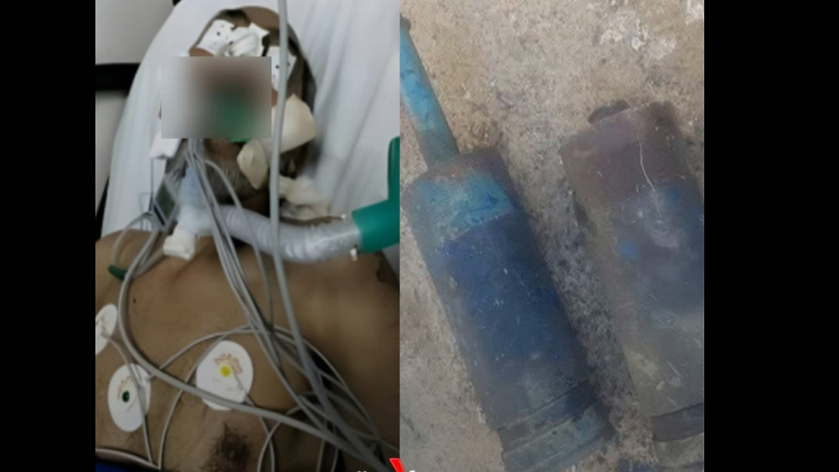 المنستير البقالطة إنفجار قذيفة من مخلفات الحرب العالمية الثانية وإصابة فلاح اصابة بليغة