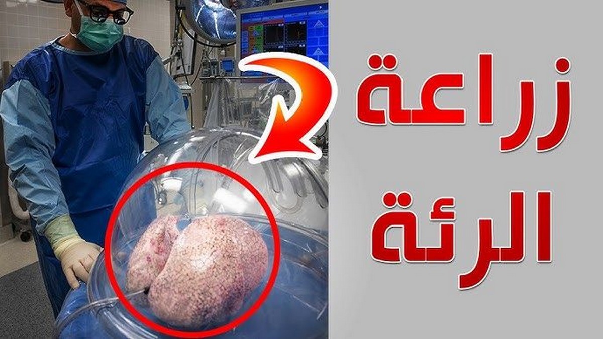 حدث طبي هام في المستشفى الجامعي الحبيب بورقيبة بصفاقس… أشرف المذيوب