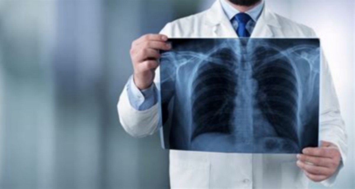 صفاقس بين الإنسانية والتفاني: قسم الأمراض الصدرية بمستشفى الهادي شاكر نموذج يُحتذى به.