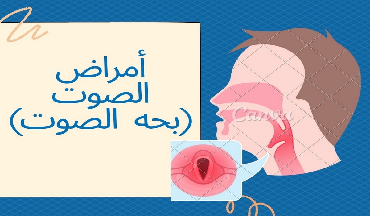 صفاقس يوم مفتوح لتقصي أمراض الصوت بصفة مجانية